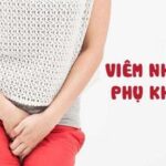 Chữa viêm nhiễm phụ khoa bằng đông y