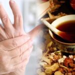 Đông y chữa viêm khớp dạng thấp thế nào?