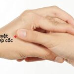 Bấm huyệt chữa đột quỵ có phục hồi được không?