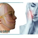 Bấm huyệt chữa đau dây thần kinh số 5