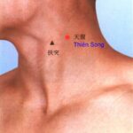 Vị trí và tác dụng của huyệt Thiên Song