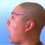 Tác dụng của huyệt huyền lư