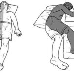 Liệt nửa người có thể hồi phục không?