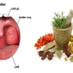 Dùng Đông y chữa viêm amidan cho trẻ