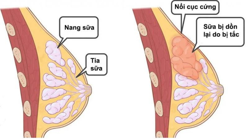 Tác dụng của cây mộc thông là gì? 6.jpg