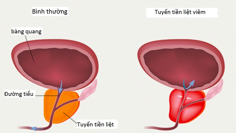 Xích thược: Vị thuốc giúp thanh nhiệt lương huyết 5